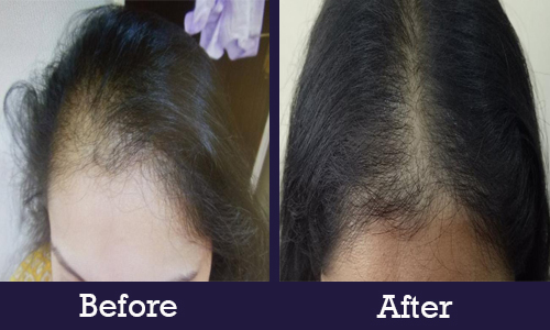 Before and After hair treatment
